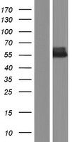 AMHR2 Human Over-expression Lysate