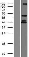 IGF2BP1 Human Over-expression Lysate