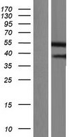 Gasdermin like (GSDMB) Human Over-expression Lysate