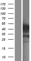 Gasdermin like (GSDMB) Human Over-expression Lysate