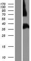 FHL1 Human Over-expression Lysate