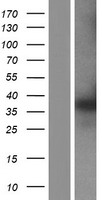 PTGR1 Human Over-expression Lysate