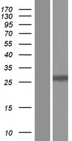 TATDN3 Human Over-expression Lysate