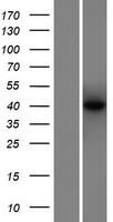 MEF2B Human Over-expression Lysate