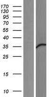 FKBP51 (FKBP5) Human Over-expression Lysate