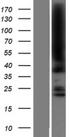 JMJD5 (KDM8) Human Over-expression Lysate