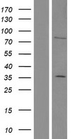 SnoN (SKIL) Human Over-expression Lysate