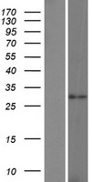 LGALS12 Human Over-expression Lysate