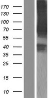 RNF156 (MGRN1) Human Over-expression Lysate