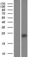 Nkx2.6 (NKX2-6) Human Over-expression Lysate