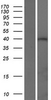 ATXN3L Human Over-expression Lysate