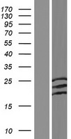 Acid Phosphatase 2 (ACP2) Human Over-expression Lysate
