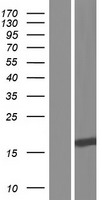 SAP30L Human Over-expression Lysate