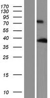 ANKRD2 Human Over-expression Lysate