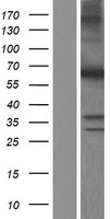 MYH (MUTYH) Human Over-expression Lysate