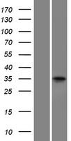 Pit1 (POU1F1) Human Over-expression Lysate