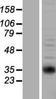 NAT2 Human Over-expression Lysate