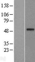 DDB2 Human Over-expression Lysate