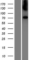 Galactosylceramidase (GALC) Human Over-expression Lysate