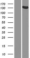 GUCY2D Human Over-expression Lysate
