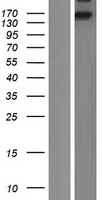 Insulin Receptor (INSR) Human Over-expression Lysate