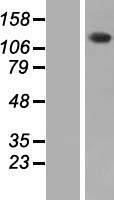 PHKA2 Human Over-expression Lysate