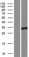 Pit1 (POU1F1) Human Over-expression Lysate