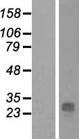 QDPR Human Over-expression Lysate