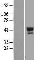 Thyroxine Binding Globulin (SERPINA7) Human Over-expression Lysate