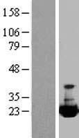 alpha A Crystallin (CRYAA) Human Over-expression Lysate