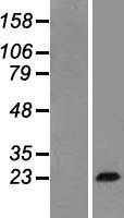 Growth Hormone (GH1) Human Over-expression Lysate