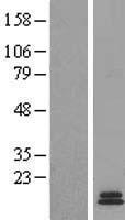 Gastrin (GAST) Human Over-expression Lysate