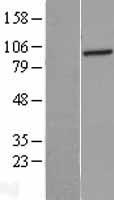 PFKL Human Over-expression Lysate