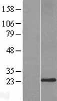 DERL3 Human Over-expression Lysate