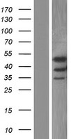 LYK5 (STRADA) Human Over-expression Lysate