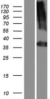 PLAUR Human Over-expression Lysate