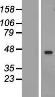 TMEM201 Human Over-expression Lysate