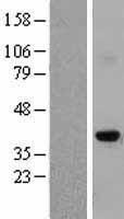 Aurora C (AURKC) Human Over-expression Lysate