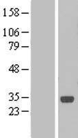 C1ORF190 (LURAP1) Human Over-expression Lysate