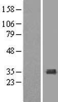 SULT1A4 Human Over-expression Lysate