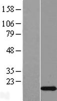 C2orf76 Human Over-expression Lysate