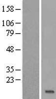 TEKT4P2 Human Over-expression Lysate