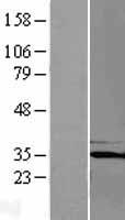 PQBP1 Human Over-expression Lysate