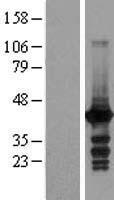 MRI1 Human Over-expression Lysate