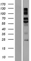KREMEN1 Human Over-expression Lysate