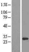 EEF1B2 Human Over-expression Lysate