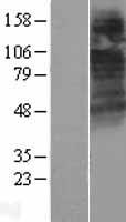 CTNS Human Over-expression Lysate