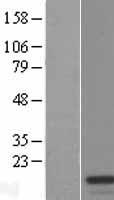 TXNRD3IT1 (TXNRD3NB) Human Over-expression Lysate
