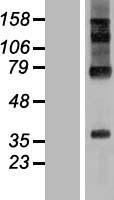 RHBDD2 Human Over-expression Lysate