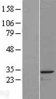 PACRG Human Over-expression Lysate